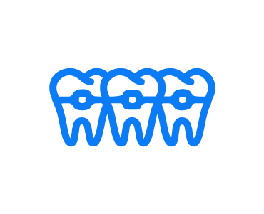 <span style="font-weight: bold;">Установка брекетов</span><br>