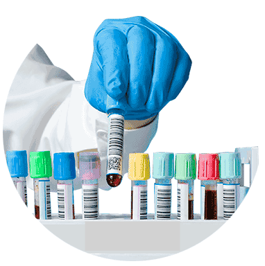 Сдать анализ крови в лаборатории Сдать анализ крови в лаборатории